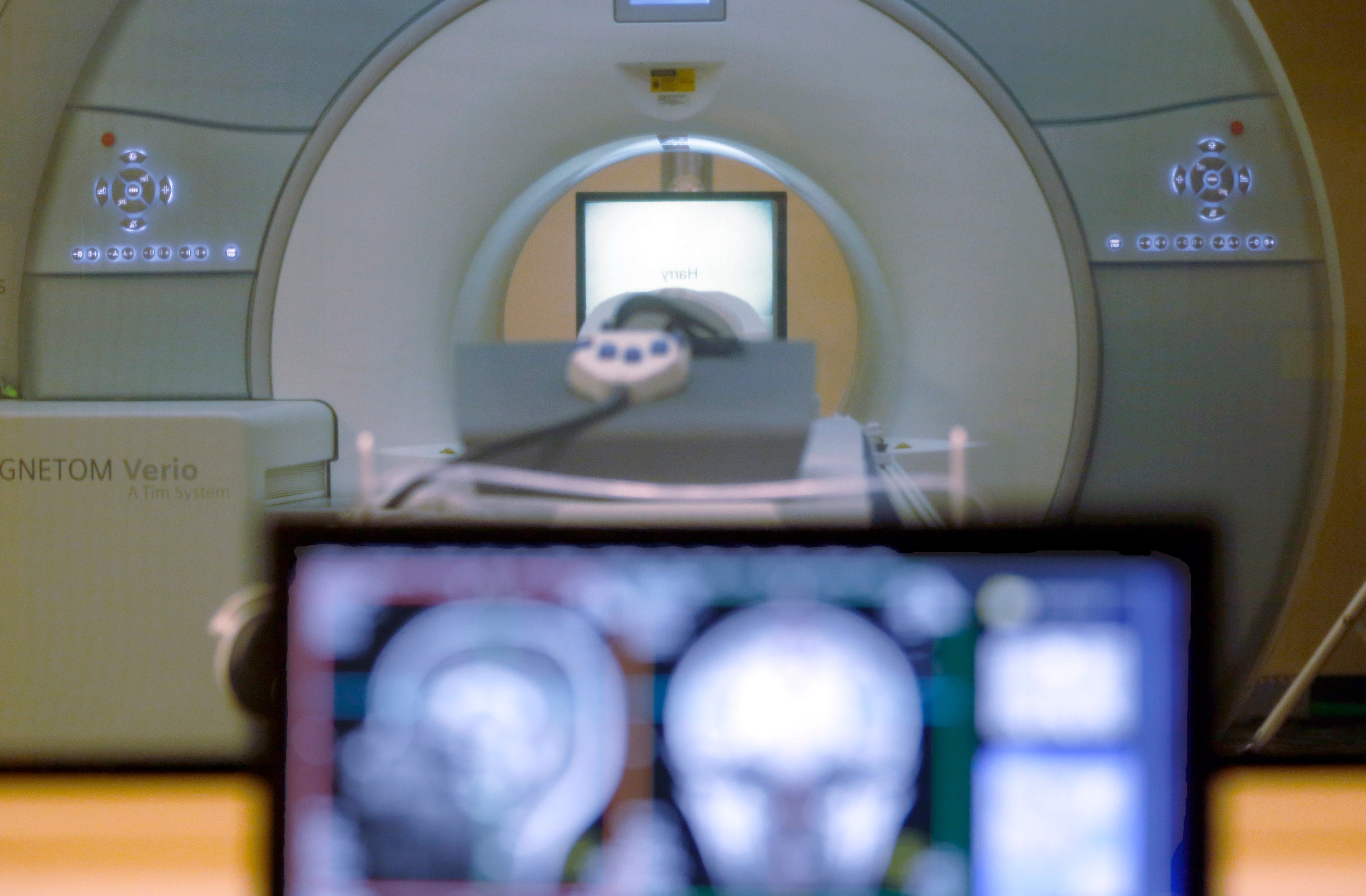 Penn leads $26 million NIH study to identify early signs of ALS and frontotemporal dementia