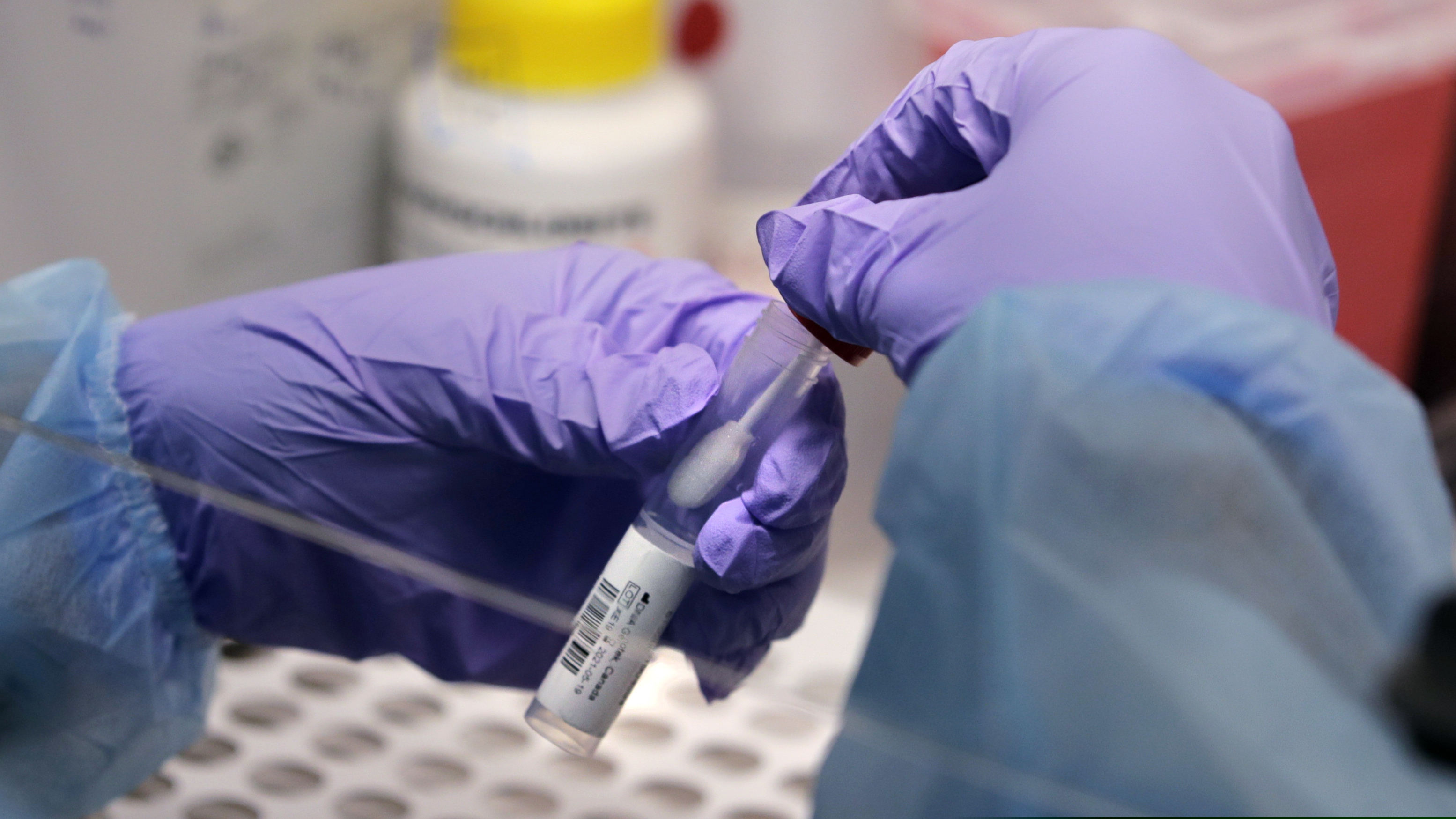 A biomedical engineering graduate student holds a swab and a specimen vial in preparation for COVID-19 diagnostic testing at Boston University in Boston. Some labs are testing samples in batches to try to increase testing capacity and speed up reporting of results.