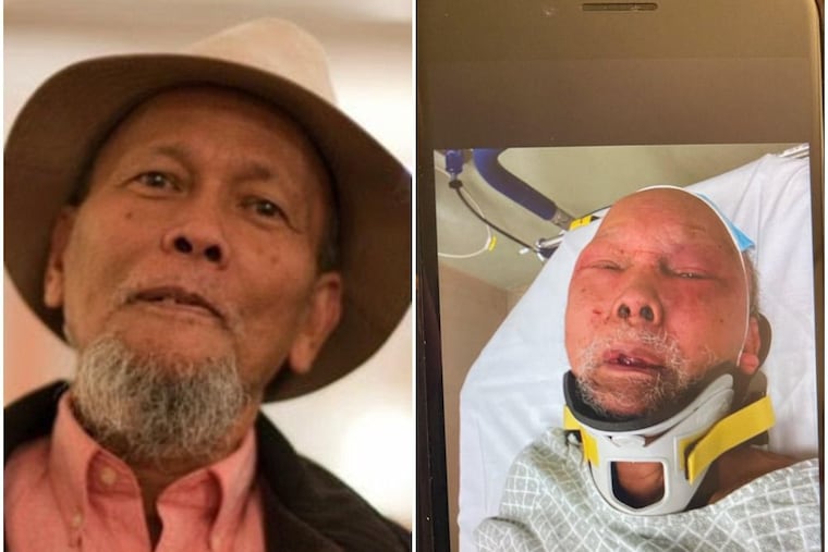 Mauricio Gesmundo Sr., 83, seen before (left) and after (right) he was attacked during a home-invasion robbery in Hunting Park on Dec. 31.