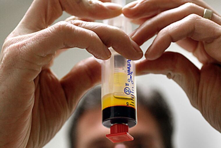 Dr. David Berkoff loads platelet-rich blood plasma, shown in yellow above the remaining red blood, from a patient at Duke Health Center at Southpoint Durham, North Carolina. (Ted Richardson/Raleigh News & Observer/MCT)