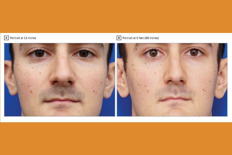 The left portrait was taken from 12 inches away, causing the nose to appear wider than in the portrait on the right, which was taken from 5 feet. A Rutgers-Stanford study measured the distortion.