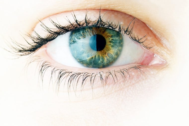 We’ll call them hoodie eyes.