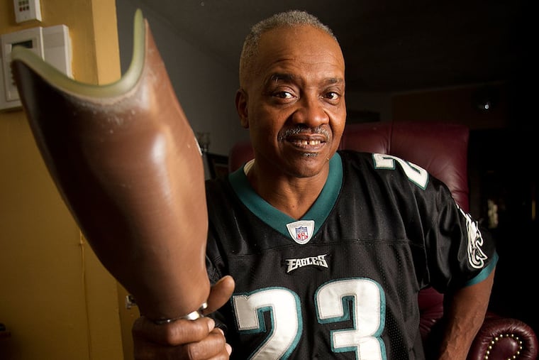 Sonny Forriest Jr., a Philadelphia resident who sings at Lincoln Financial Field during Eagles games. He had his prosthetic leg stolen outside the stadium Sunday, October 12, 2014. Photograph taken at his home on Monday, October 13, 2014. ( ALEJANDRO A. ALVAREZ / STAFF PHOTOGRAPHER )
