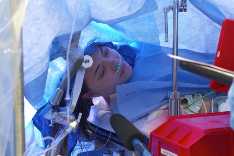 A screenshot from a Facebook Live video in which medical personnel at Methodist Dallas Medical Center can be seen communicating with patient Jenna Schardt as she undergoes an awake brain surgery Tuesday morning to remove a mass in her brain.