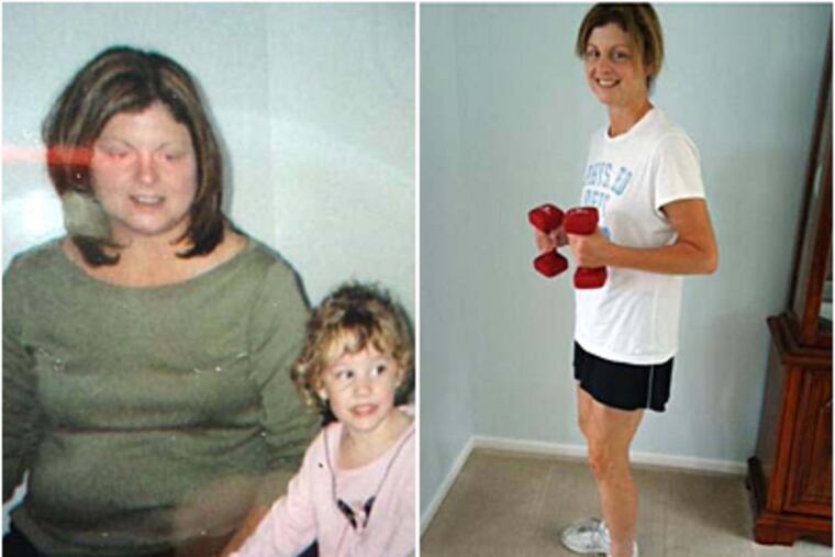 Before and after photos of Peggy Weber Bradford of Washington Township, N.J.