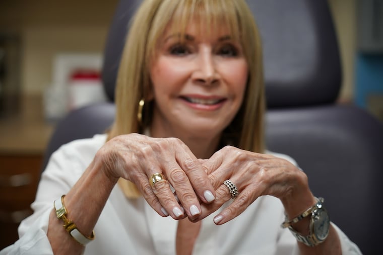 Connie Veneri-Kelley prior to receiving a restalyne lift hand treatment at Davis Cosmetic Plastic Surgery, in New Jersey, October 11, 2018. JESSICA GRIFFIN / Staff Photographer