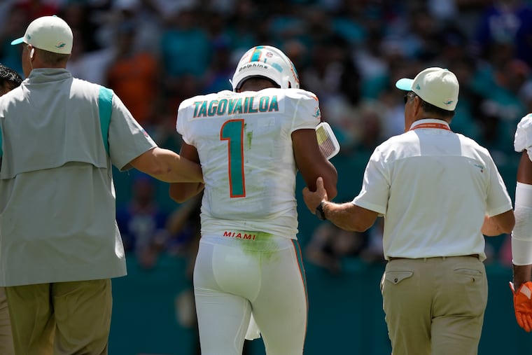 Miami Dolphins quarterback Tua Tagovailoa's physical response to a concussion on Sept. 25, 2022, led to a new study into a previously overlooked brain injury symptom.