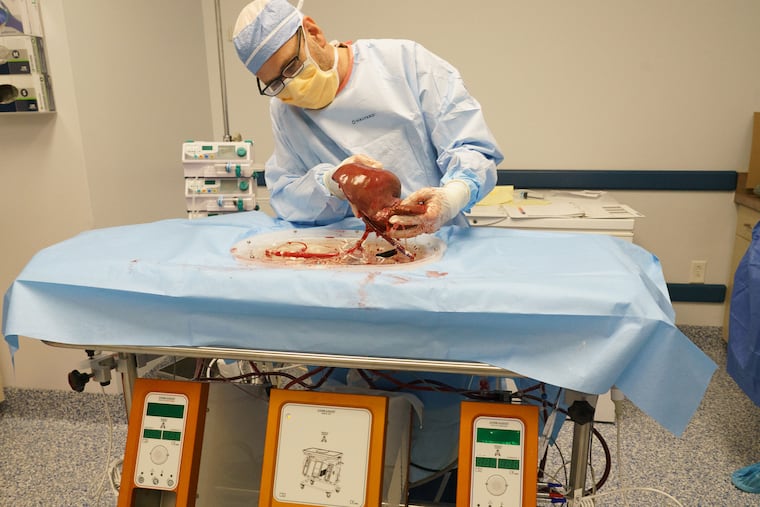 David J. Reich, a Hahnemann University Hospital transplant surgeon and professor at Drexel University, examines a human liver as it is perfused with nutrients.