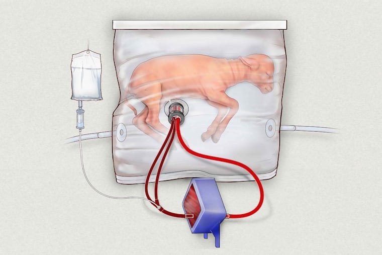 With colleagues at Children’s Hospital of Philadelphia, fetal surgeon Alan W. Flake kept extremely premature lambs alive for weeks inside a fluid-filled bag.