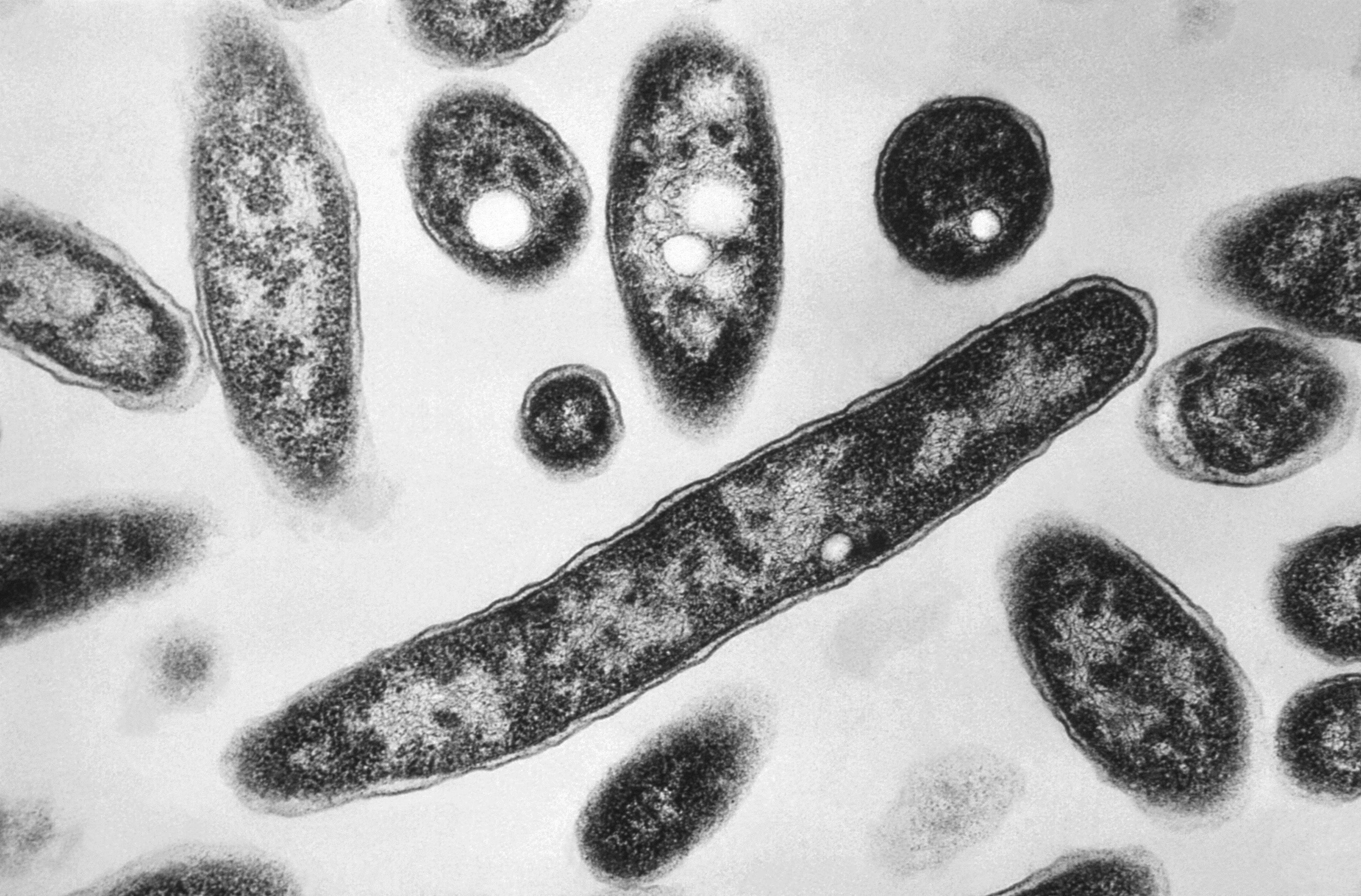 First death reported in Legionnaires' disease outbreak in New York City