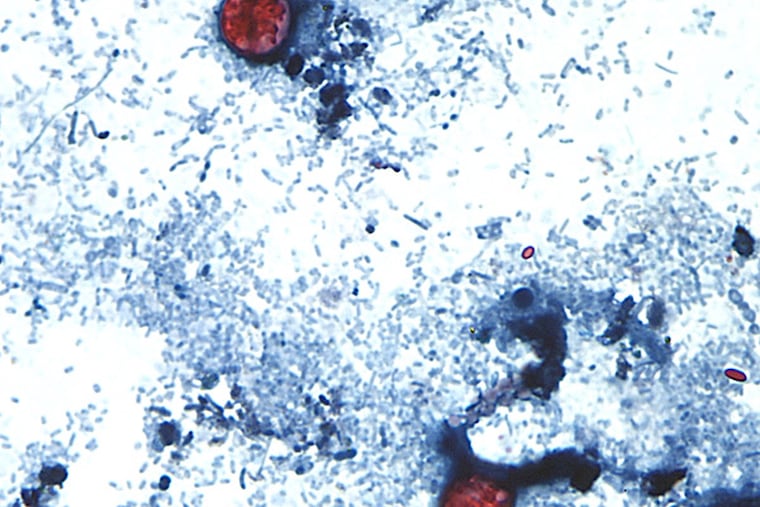 This undated photo taken through a microscope provided by the CDC shows Cyclospora cayetanensis oocysts found in a fresh stool sample which had been prepared with a formalin solution and stained with safranin.