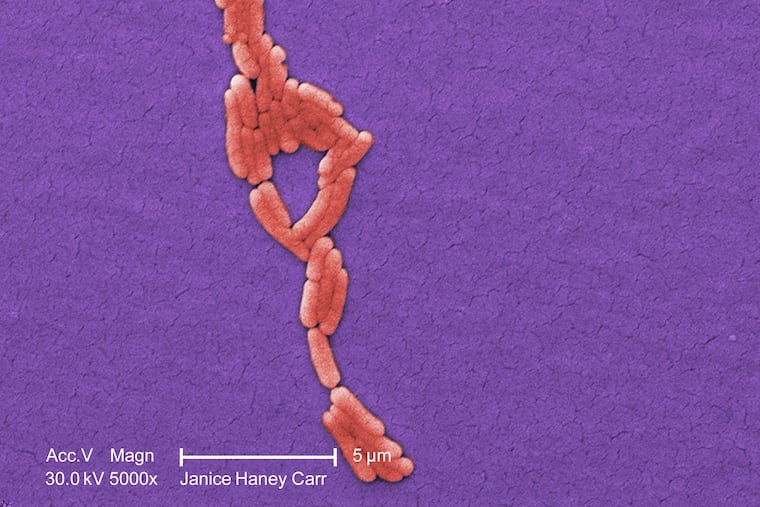 A microscopic image of clustered Gram-negative, Salmonella typhimurium bacteria, isolated from a pure culture.