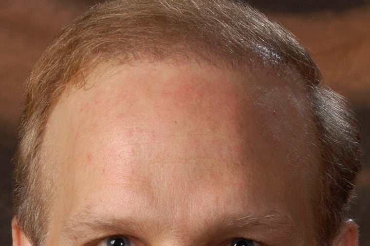 Penn's Kenneth B. Margulies said people should not quit the drug.