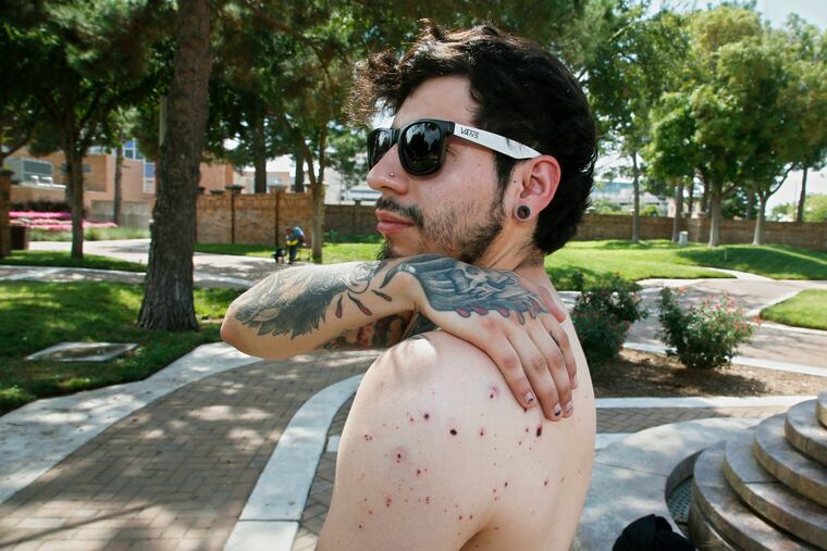 Daniel Munoz reaches for his injured back during an interview, Sunday, Sept. 1, 2019, in Odessa, Texas. Munoz was injured in Saturday's shooting. The tattoo on his right hand is a biblical reference, that the wages of sin are death and God's gift is everlasting life.