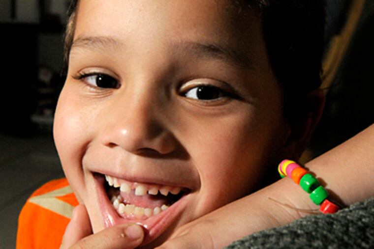 Raul Estrada, 6, of Hialeah, Fla., points out the two bottom permanent teeth that grew in where he had two baby teeth harvested for their stem cells. (Marice Cohn Band/Miami Herald/MCT)