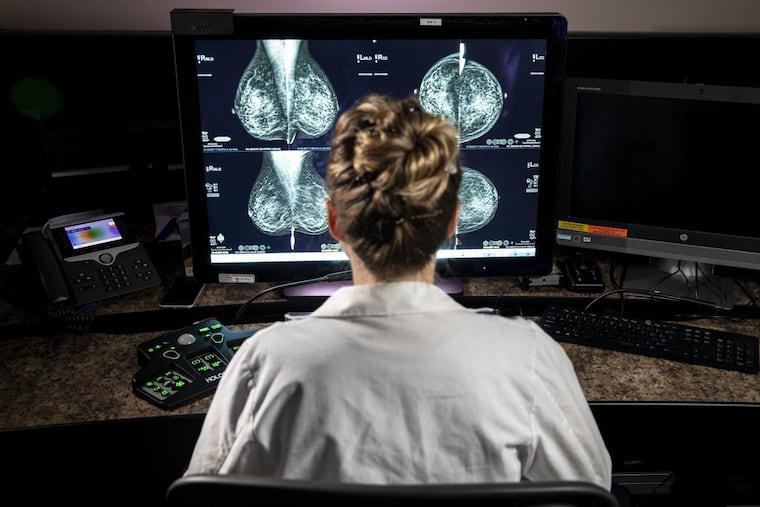 Hannah Milch, assistant clinical professor, Department of Radiology at the David Geffen School of Medicine at UCLA is photographed reviewing a mammogram in 2021. (Jay L. Clendenin / Los Angeles Times/TNS)