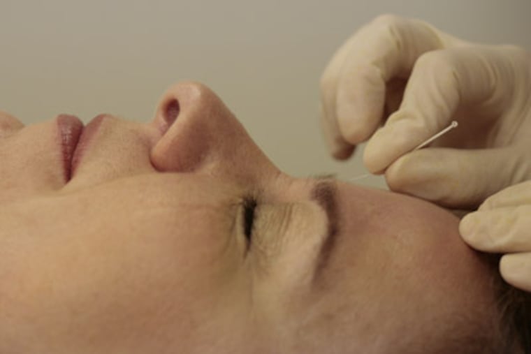 The analysis examined 29 studies involving almost 18,000 adults. The researchers concluded that the needle remedy worked better than usual pain treatment and slightly better than fake acupuncture. That kind of analysis is not the strongest type of research, but the authors took extra steps including examining raw data from the original studies. (AP Photo)