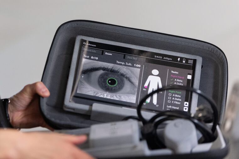 Clinical trials are expected to begin in about two month on the Nociometer, a device designed to determine the type of pain and its intensity. MUST CREDIT: Candace Dane Chambers/For The Washington Post