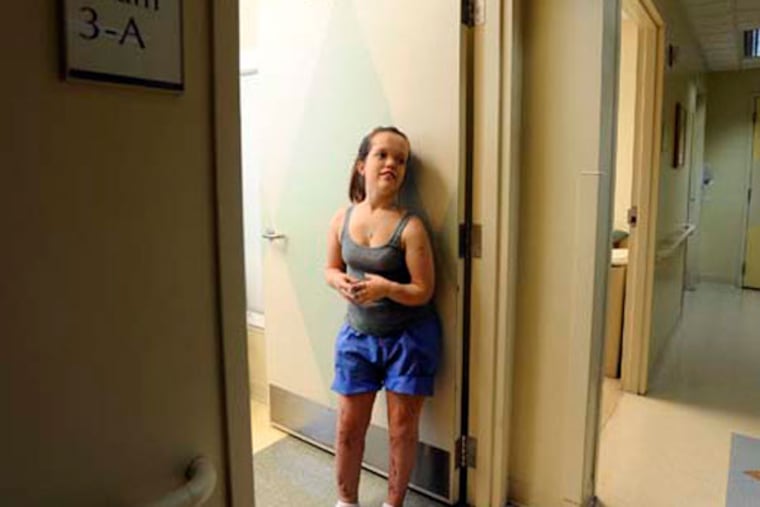 Chandler Crews, 20, at Sinai Hospital's Rubin Institute for Advance Orthopedics in Baltimore, where she had undergone limbs lengthening procedures using internal fixators. (Kenneth K. Lam/Baltimore Sun/MCT)