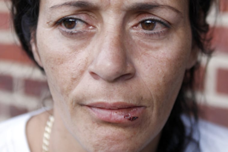 Aida Guzman's lower lip shows the souvenir from Sunday's Puerto Rican Day Parade. (Yong Kim / Staff Photographer)