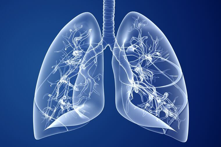 With COPD, air gets trapped in the lungs, which leads to a patient feeling as though they cannot breathe.