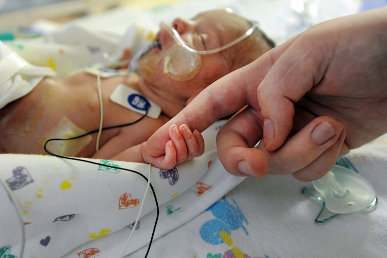 A baby at the NICU at St. Christopher's Hospital in Philadelphia. A Center City company is pursuing technology that would create an artificial womb for babies born prematurely.