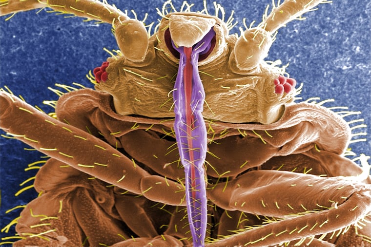 This digitally-colorized image of a bedbug from the U.S. Centers for Disease Control and Prevention. From this view you can see the insect’s skin piercing mouthparts it uses to obtain its blood meal, as well as a number of its six jointed legs.