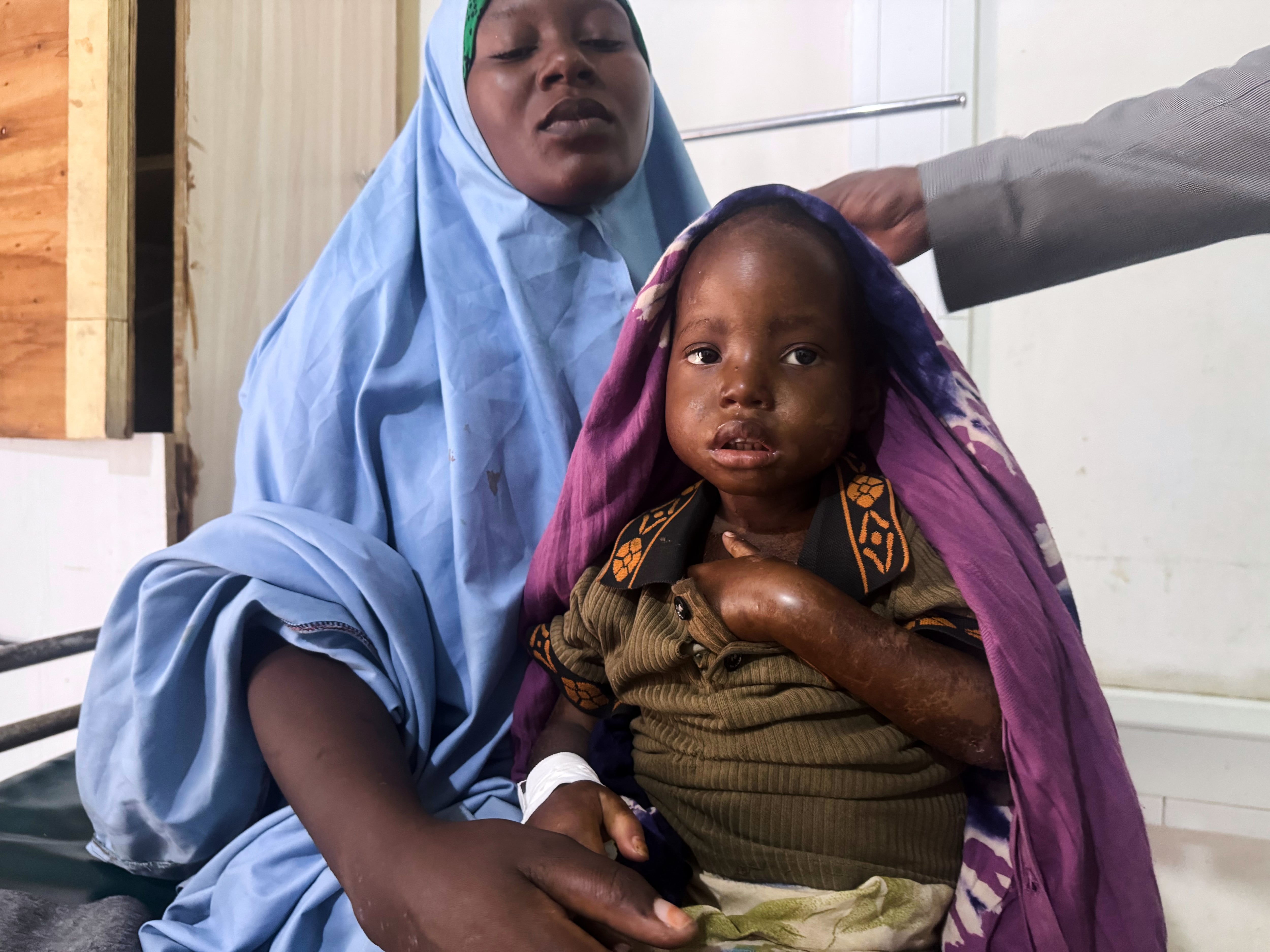 Mother's 3-day walk with sick daughter highlights Somalia's child malnutrition emergency