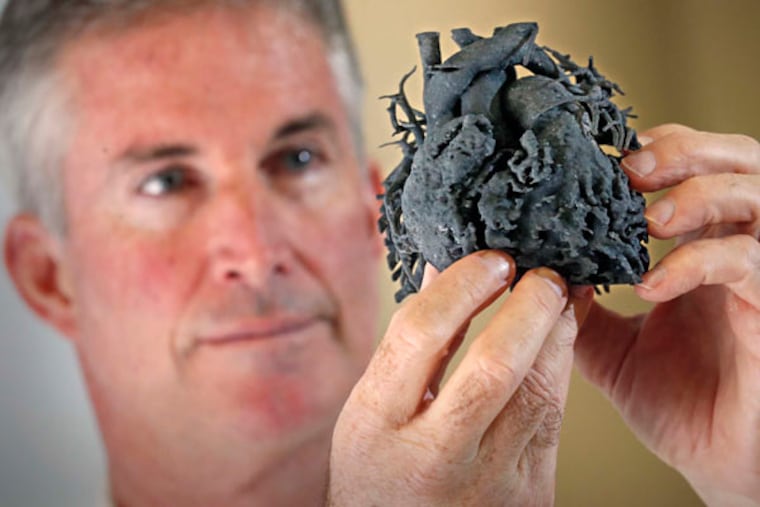 Redmond P. Burke, Chief Division of Cardiovascular Surgery in the Heart Program at Miami Children's Hospital with the 3D heart on January 14, 2015, in Miami. The Heart Program at Miami Children's Hospital is the first in the region to use 3D printing technology to create a model of a patient's heart to plan the surgery for a child born with a heart anomaly. The 3D heart was used to manipulate the vessels and explore possible repairs prior to the surgery. (Al Diaz/Miami Herald/TNS)