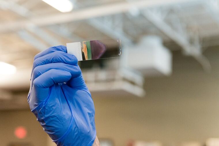 A lab technician inspects a urine sample at the Comprehensive Pain Specialists (CPS) lab in Brentwood, Tenn.
