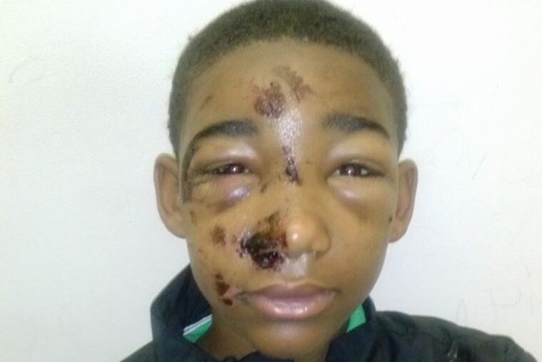 Based on his extensive facial injuries, Marissa Sargeant said she believes police assaulted her son, Joseph Williams, 14 (pictured). (Photo provided by Marissa Sargeant)