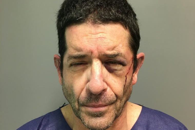 Jamison Bachman of Philadelphia is accused by Montgomery County authorities of killing his brother Harry Bachman at Harry's home in Elkins Park.