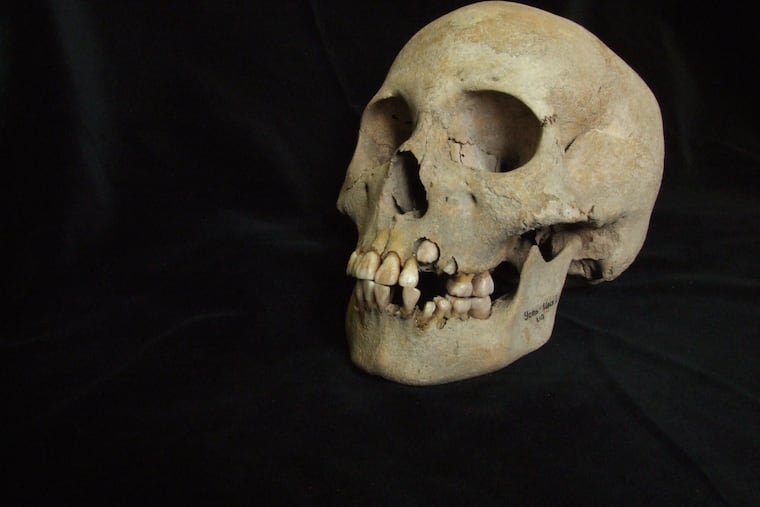 This 2006 image from Angela Lieverse shows the skull of a young girl who was buried with victims of the plague in Siberia.