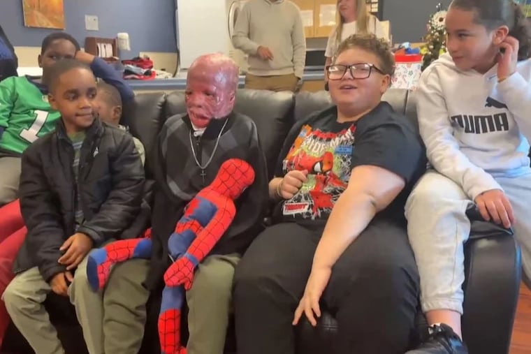 Ramesses Vazquez Viana spent months in the hospital after suffering burns to 90% of his body in the Northeast Philadelphia plane crash on Jan. 31. Vazquez-Viana and his friends before the event Monday celebrating his return home.