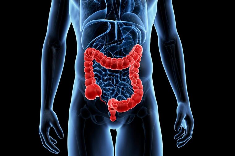 Colon cancer screening for people at average risk is recommended to start at age 50.