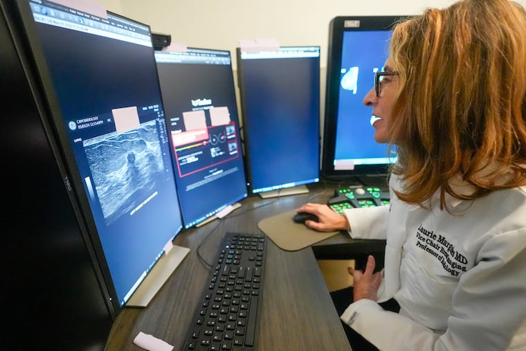 Dr. Laurie Margolies demonstrates how breast imaging AI is used to get a second opinion on mammography ultrasounds at Mount Sinai hospital in New York. “I will tell patients, ‘I looked at it, and the computer looked at it, and we both agree,’” Margolies said. “Hearing me say that we both agree, I think that gives the patient an even greater level of confidence.”