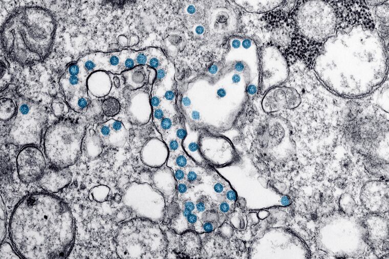 This 2020 electron microscope image made available by the U.S. Centers for Disease Control and Prevention shows the spherical particles of the new coronavirus, colorized blue, from the first U.S. case of COVID-19.