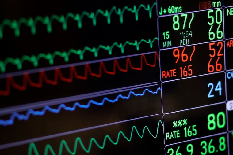FILE - A screen displays a patient's vital signs at a hospital in Baltimore on Nov. 28, 2016.