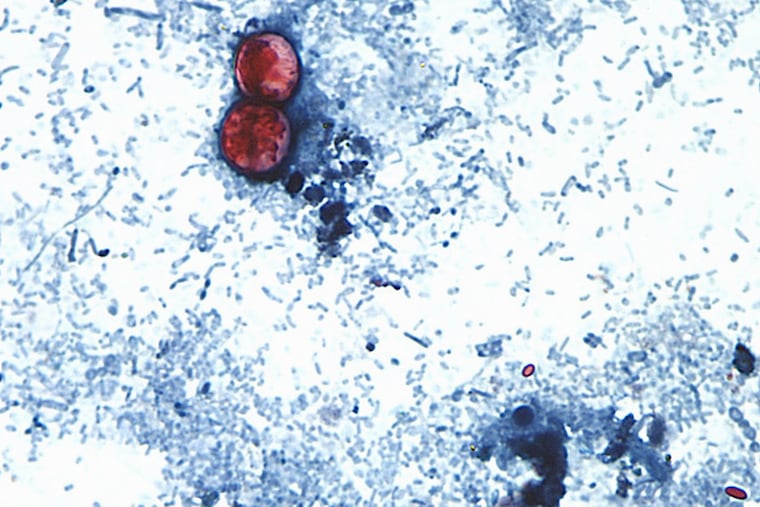 CDC expands largest known U.S. cyclospora outbreak to 9 states, including Pennsylvania CDC expands largest known U.S. cyclospora outbreak to 9 states, including Pennsylvania