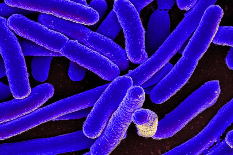 Escherichia coli (E. coli) in a scanning electron micrograph.
