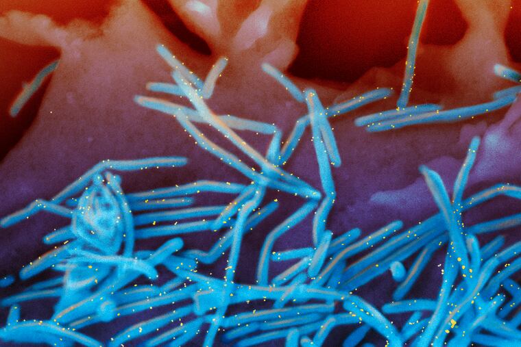 This electron microscope image provided by the National Institutes of Health shows human respiratory syncytial virus (RSV) virions, colorized blue, and anti-RSV F protein/gold antibodies, colorized yellow, shedding from the surface of human lung cells. Advisers to the Food and Drug Administration on Thursday debated a first-of-its-kind RSV vaccine to protect newborns by immunizing their moms late in pregnancy.