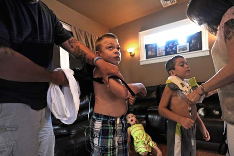Jeff Leider, far left, shows Jason's, 8, scar from his most recent surgery as Deena Ledier, right, puts Justin's, 6, shirt back on after showing the IV of medications both boys receive on July 13, 2015 in Elmwood Park, N.J. Both boys have Hunter sydrome, a rare genetic disease that causes damage to the brain. (Danielle Parhizkaran/The Record/TNS)