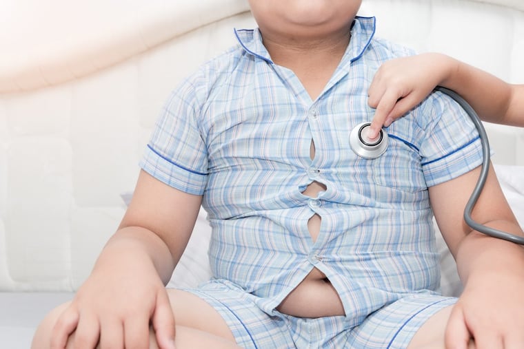 An overweight child. Diet and exercise can help.