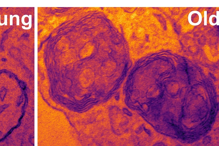 These pictures show autophagosomes within neurons of young and old mice. Autophagosomes are parts of cells that surround damaged structures, a step in the process of recycling cell materials that is called autophagy. The image from the young mouse shows two normal autophagosomes, which have a double-membrane around their perimeters, containing cellular garbage targeted for degradation. The two autophagosomes from the old mouse have seven layers instead of two, indicating that they did not form properly. There are so many membranes stacked on each other in the autophagosomes from the old mouse that there is very little room to contain cellular garbage for recycling.