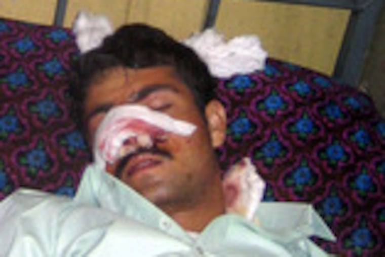 A wounded policeman liesin a hospital after yesterday's suicide bombing in Kunduz province, which killed 10.
