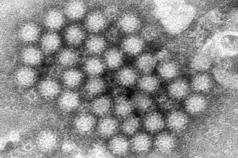 Norovirus is a highly contagious virus that can spread through close contact with an infected person or with contaminated food, water, and surfaces.