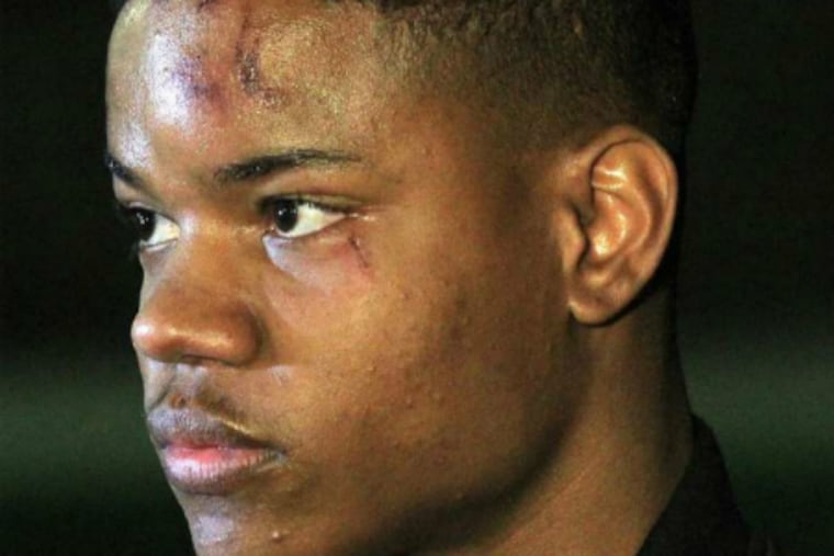 Martese Johnson was on hand Wednesday as fellow students protested his arrest.