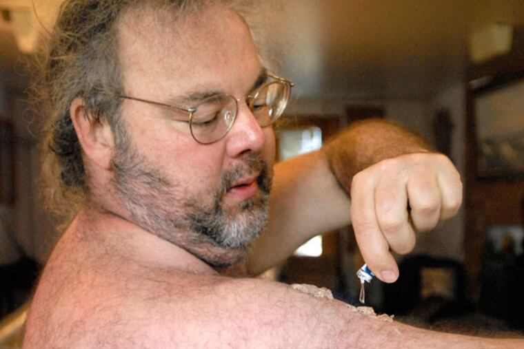In this photograph taken on Friday, Sept. 11, 2009, Basil Irwin applies AndroGel testosterone gel at his home in Hygiene, Colo. Irwin says that with testosterone replacement therapy he feels much more energetic, has better libido and in general has an improved sense of well being. (AP Photo/The Longmont Times-Call, Richard M. Hackett)