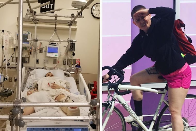 Becca Refford, 24, was struck by a truck while riding her bike in Center City. She suffered a broken pelvis, shattered hip, and other injuries and is recovering at Thomas Jefferson University Hospital.
