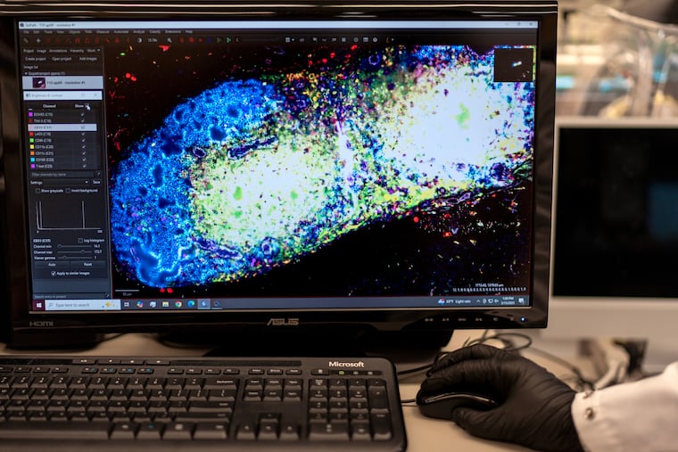 An image of a pancreatic lymph node from a mouse at a Johns Hopkins lab where autoimmune diseases are studied. Autoimmunity research is threatened by funding cuts, writes E. John Wherry.